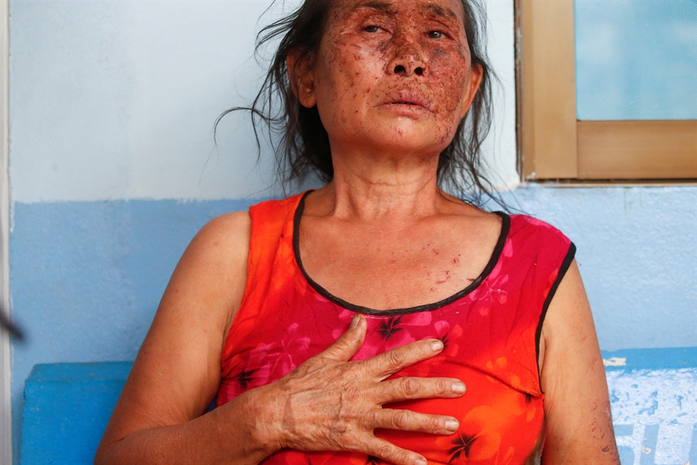 멈추지 않는 총성…미얀마가 아프다